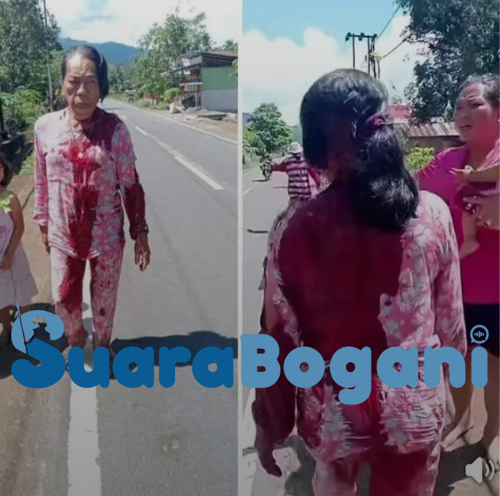 Seorang Ibu Warga Desa Tungoi Dua Dibacok Tetangga, Pelaku Diduga Mabuk