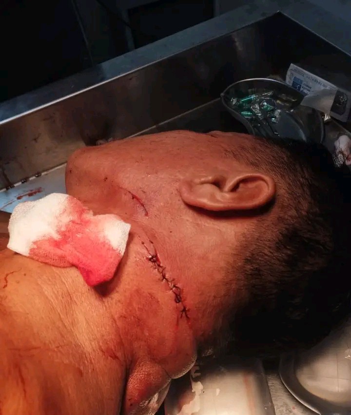 Kasus Penganiayaan Sahrin Molok Mandek, Korban Pertanyakan Penanganan Polisi